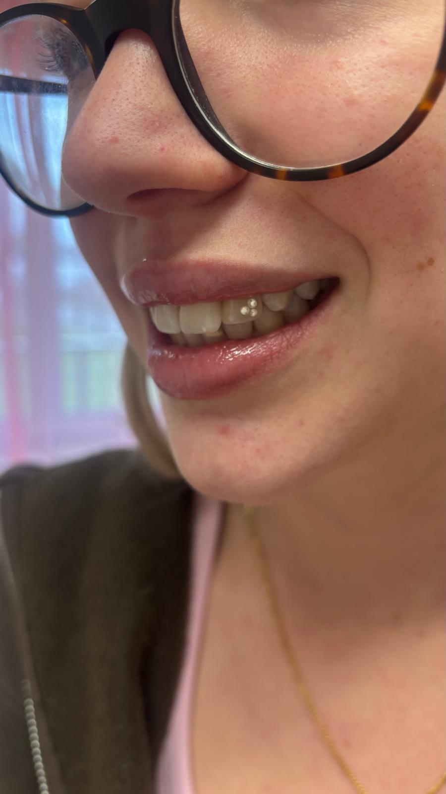 Rosafio Beauty Tooth Gems