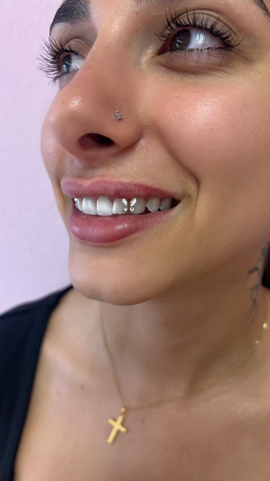 Rosafio Beauty Tooth Gems